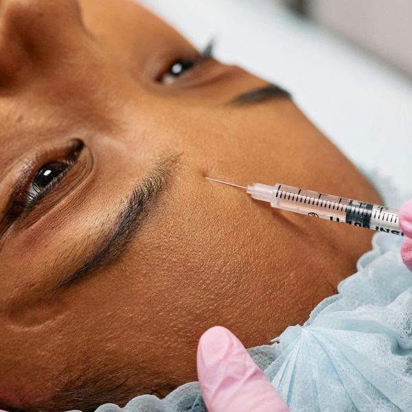 Dermal Filler